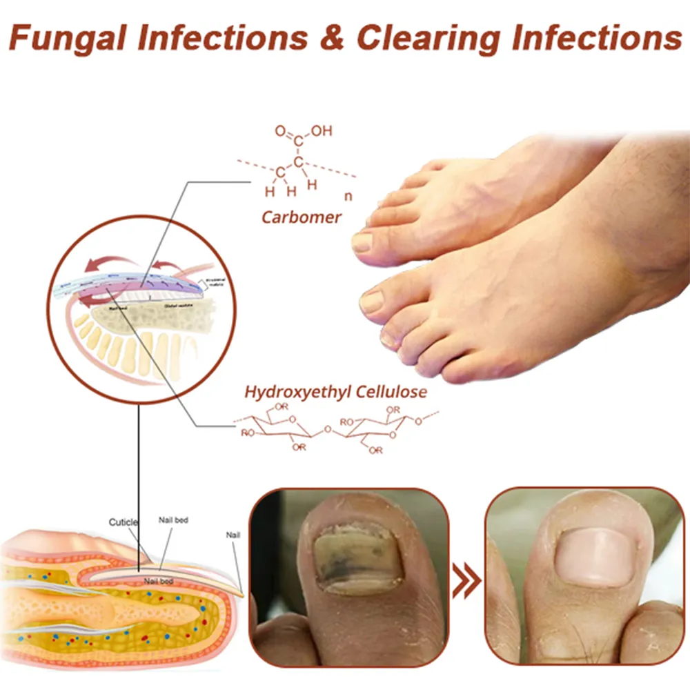 Zaho™ Revolutionary High-Efficiency Light Therapy Device For Toenail Diseases