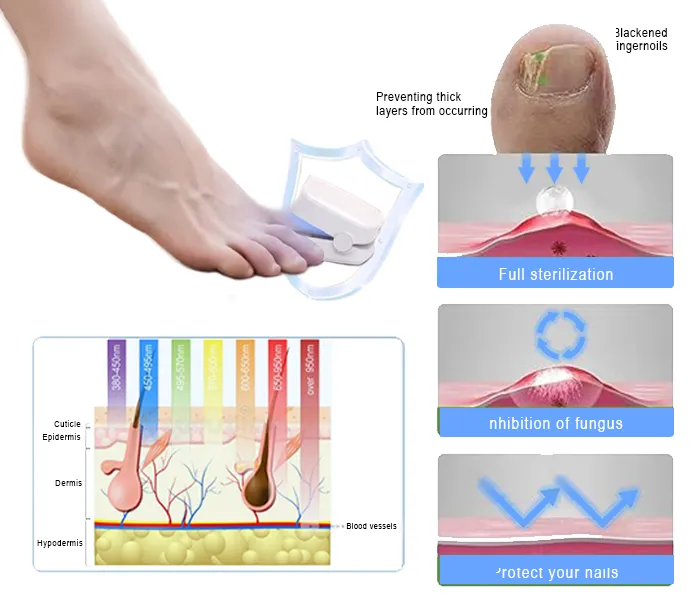 Zaho™ Revolutionary High-Efficiency Light Therapy Device For Toenail Diseases