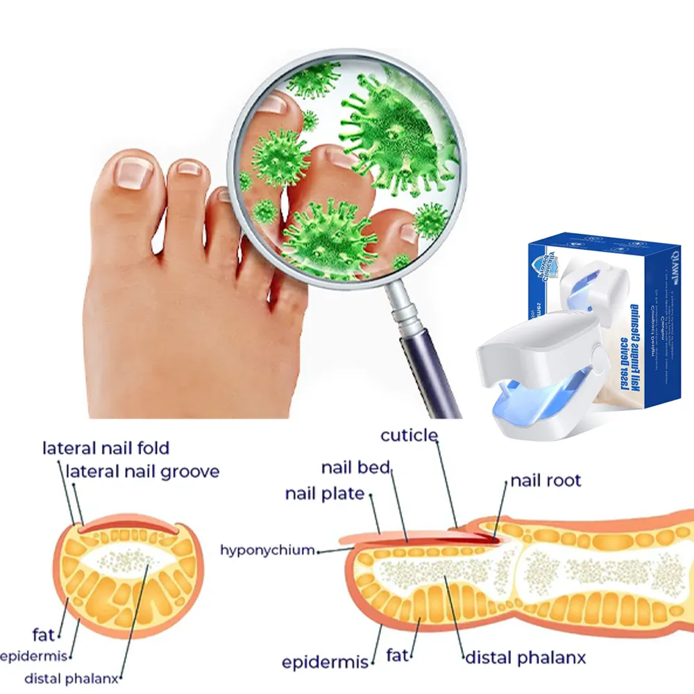 Zaho™ Revolutionary High-Efficiency Light Therapy Device For Toenail Diseases